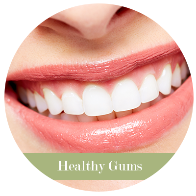 Healthy Gums